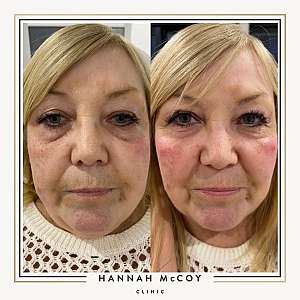 FACIAL AESTHETICS EVERYTHING YOU NEED TO KNOW